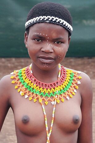 Congenital african femmes from some